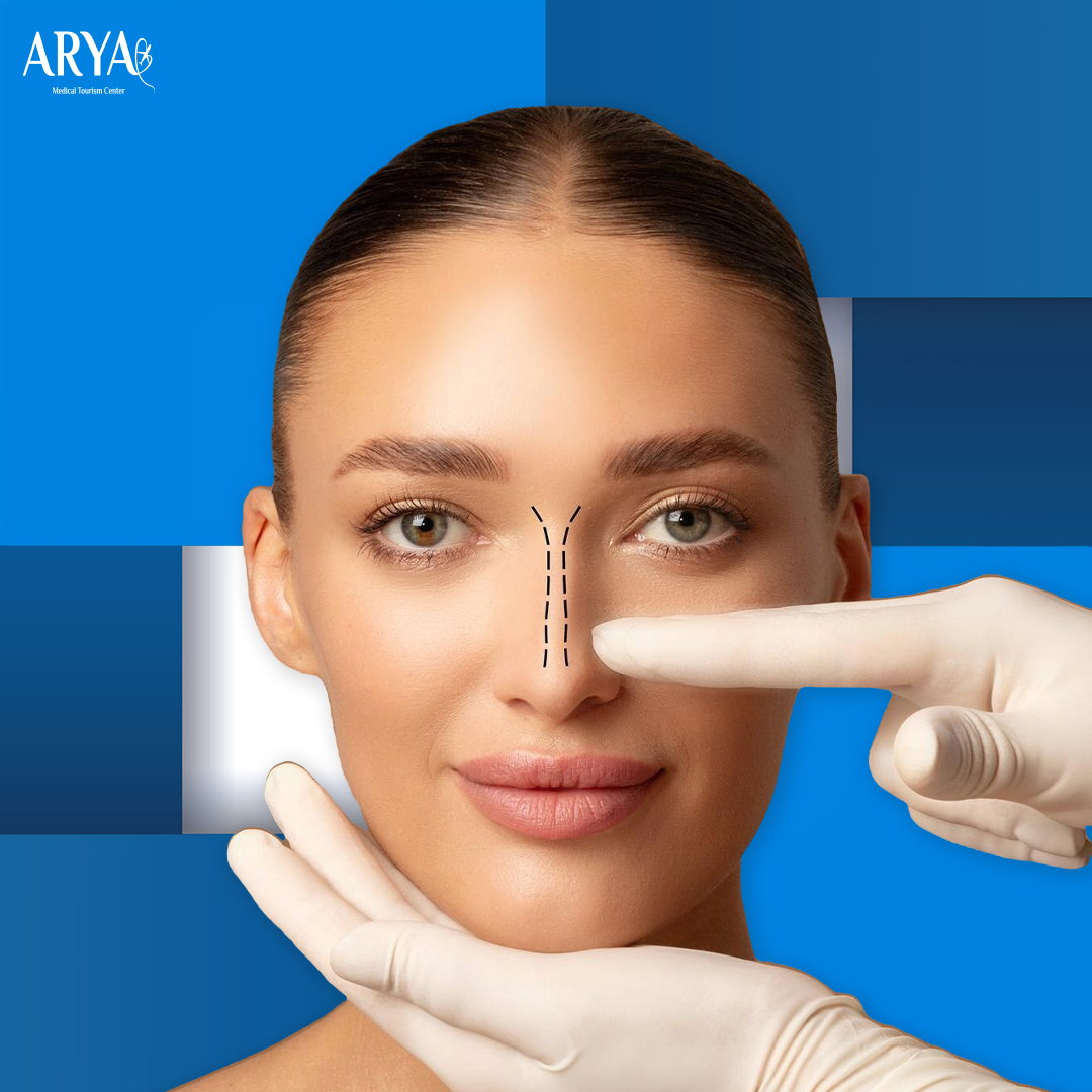 تجميل الأنف